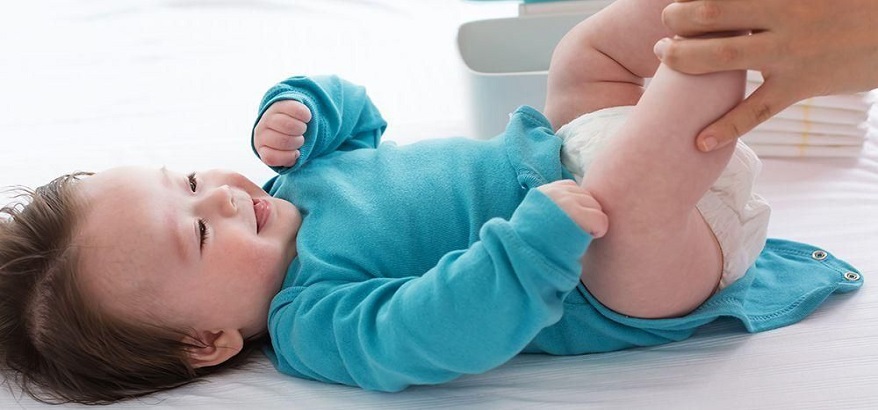 Begini Cara Mengatasi Ruam Popok Agar Tahap Perkembangan Bayi Tidak Terganggu